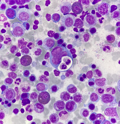 Atlas GECH - Digital Hematology preview